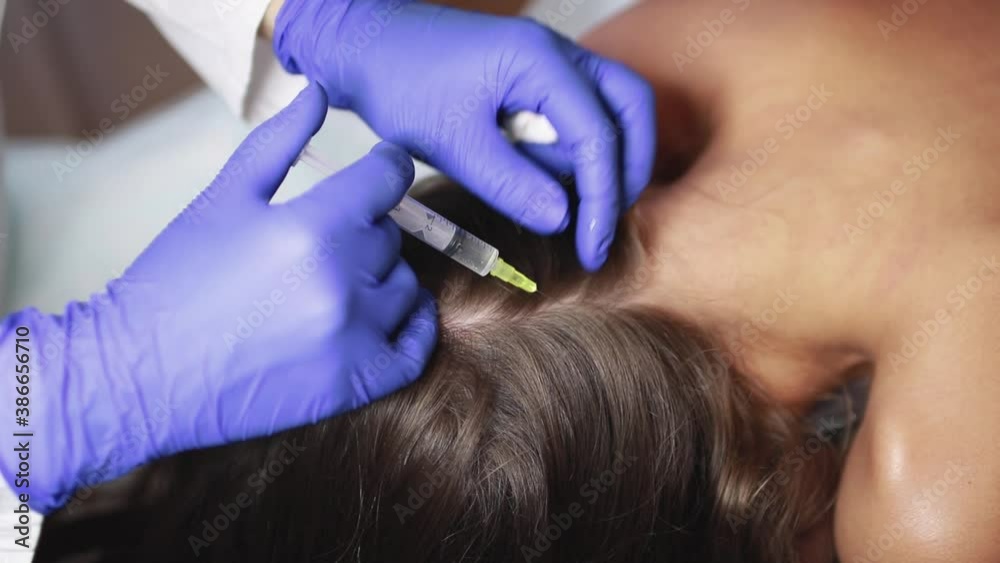 The doctor makes injections into the scalp for hair growth. Mesotherapy for hair growth and strengthening in the beauty salon. Procedure against hair loss. Close-up, selective focus. The doctor makes injections into the scalp for hair growth. Mesotherapy for hair growth and strengthening in the beauty salon. Procedure against hair loss. Close-up, selective focus.
