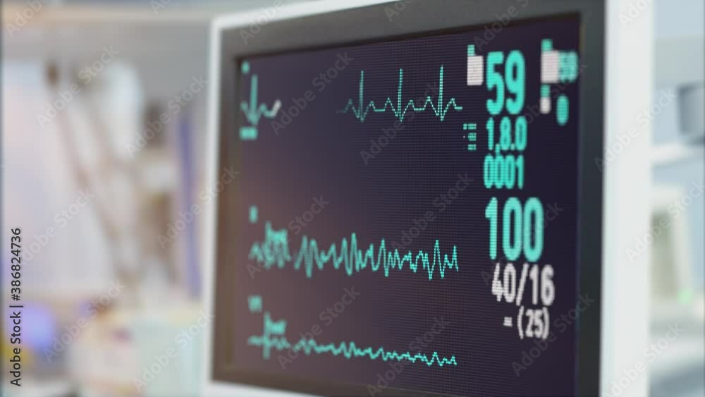 Heart rate monitor in hospital theater. Medical vital signs monitor ...