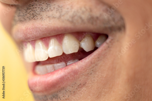 a man smiling showing his teeth