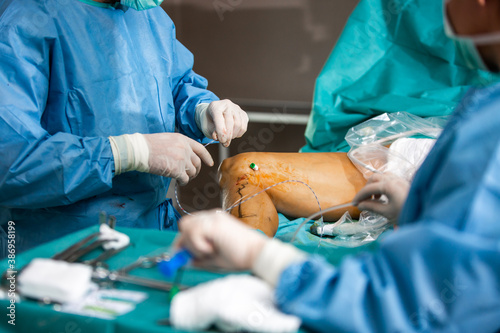 Process surgery of varicose veins in the operating room in a hospital, healtcare concept