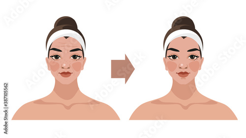 Before and after illustrations for a beauty salon, cosmetic procedures, plastic surgery, facial massage. Female portrait with age-related changes. Vector isolated on white background.