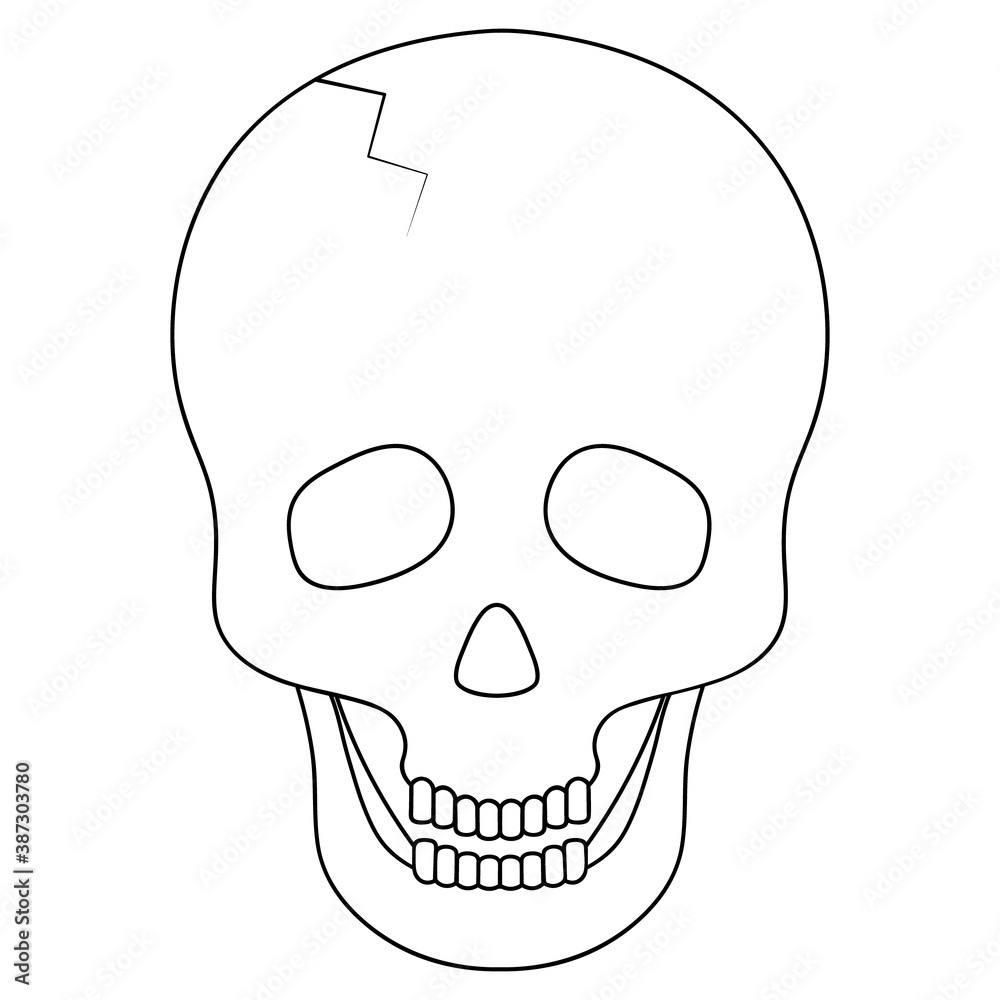 Human skull. Sketch. Crack in the forehead. Vector illustration. Bone ...