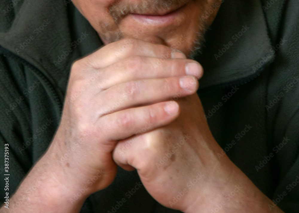Man with hands on chin