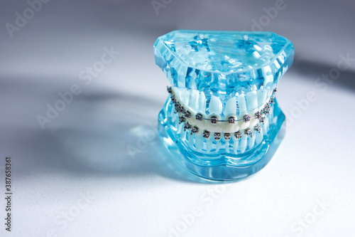 Model of a man's jaw with braces. False teeth. The concept of care for the oral cavity. Copy space