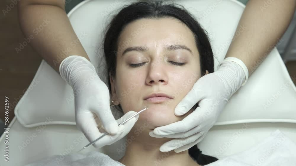 Blackhead cleansing on woman face during facial treatment at beauty
