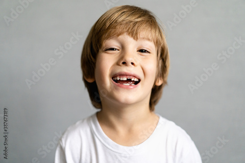 Fototapeta cute blonde boy without teeth, baby teeth fell out, children's medicine concept