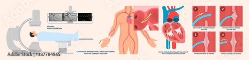Cath Lab Atrial Septal Defect Tetralogy of Fallot Patent Foramen Ovale Mitral Valve Stenosis Heart Attack Ductus Arteriosus Doppler Coronary Artery Disease Congestive Congenital Valvular VSD exam leak