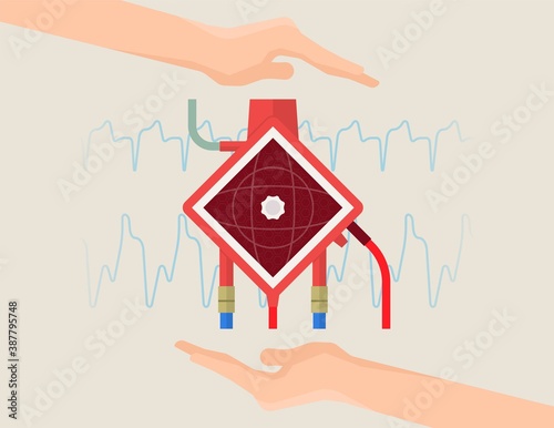 Extracorporeal membrane oxygenation ECMO a life support system for Respiratory failure patient system illness damage Infection perfusionist Ards transplant myocarditis embolism