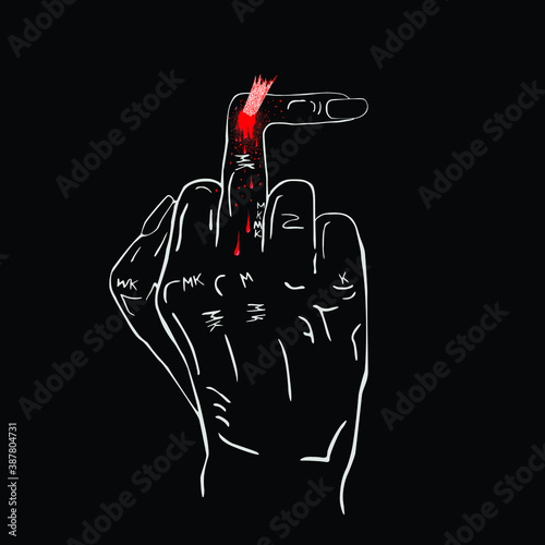 Bronken middle finger, broken fuck you finger