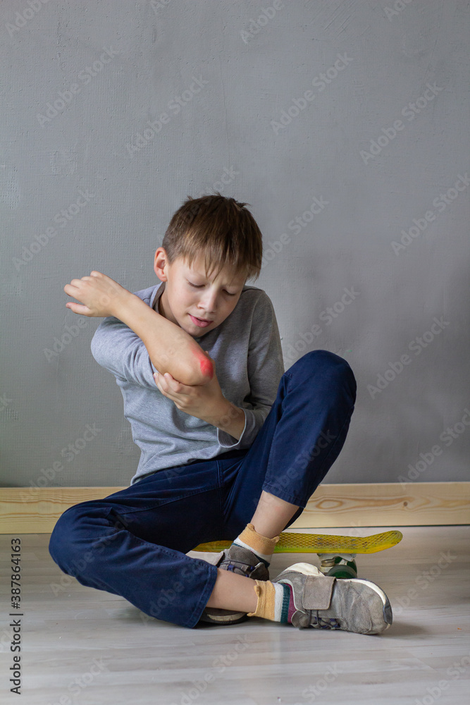 The boy sitting holds his elbow facing the injury. The child fell on a skateboard, hit his elbow