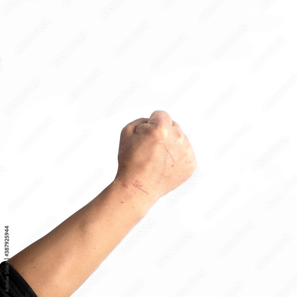 The fist is full of scars, isolated from the white background The fist is full of scars, isolated from the white background