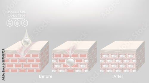 Hyaluronic acid before and after skin solutions ad, white collagen serum drop with cosmetic advertising background ready to use, illustration vector.