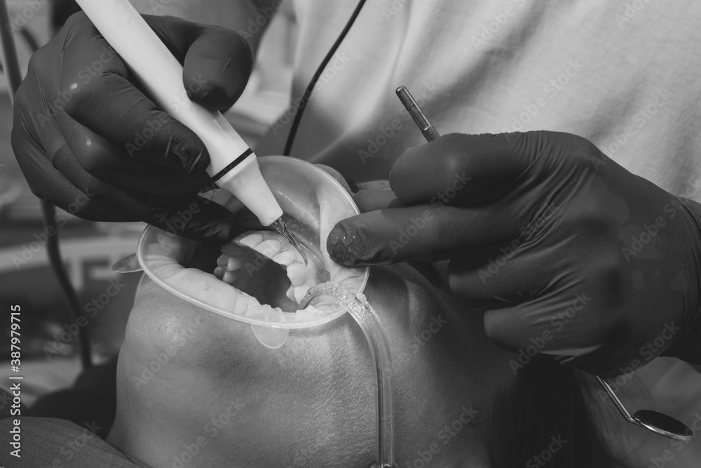 Φωτογραφία The dentist removes tartar using ultrasound, the patient at the dentist