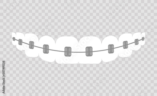 Braces transparent icon. Braces symbol design from Dentist collection. Flat vector illustration on transparent background.