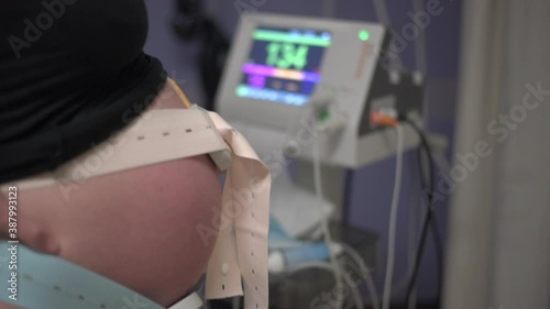 A Cardiotocograph CTG machine monitors a heavily pregnant woman's unborn baby's heartbeat in the hospital while in active labour.