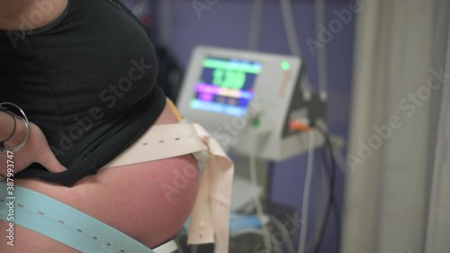 A Cardiotocograph machine monitors a heavily pregnant woman's unborn baby's heartbeat in the hospital while in active labour.