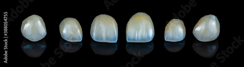 press ceramic crowns and veneers A2 color