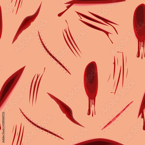 Wounds and cuts on body seamless pattern. Traumatic lacerations with leaking red blood surgical operating incisions with stitching gradual restoration of skin perfect gruesome vector murder.