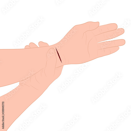 injured hand with bleeding gash with wound on the hand palm vector illustration