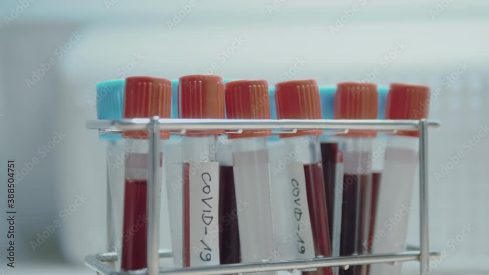 covid-19 labelled blood samples standing in a laboratory rack indoors covid-19 labelled blood samples standing in a laboratory rack indoors