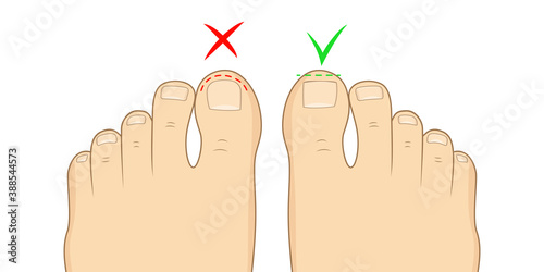 Right to cut toenails