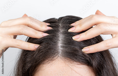 Dandruff and hair problems. The woman scratches her scalp with her hands, showing dark hair with dandruff. White background