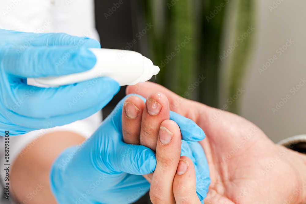 A dermatologist uses drops to treat a sick patient. Examination and diagnosis of skin diseases-allergies, psoriasis, eczema, dermatitis A dermatologist uses drops to treat a sick patient. Examination and diagnosis of skin diseases-allergies, psoriasis, eczema, dermatitis