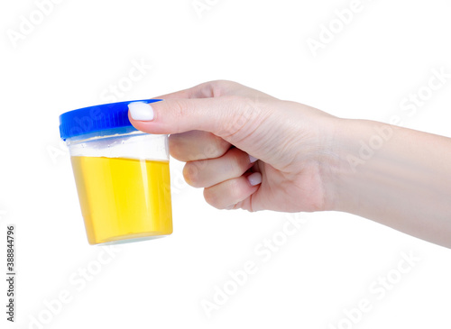 container for urine analysis in hand on white background isolation