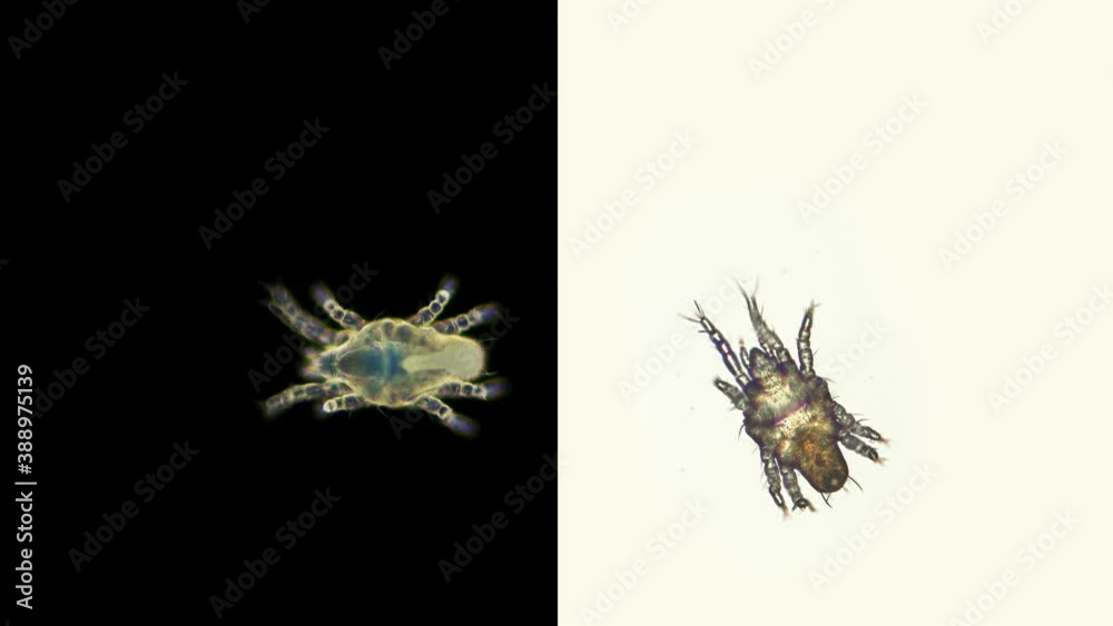 Acari (mite) of the family Tydeidae under a microscope, Order ...