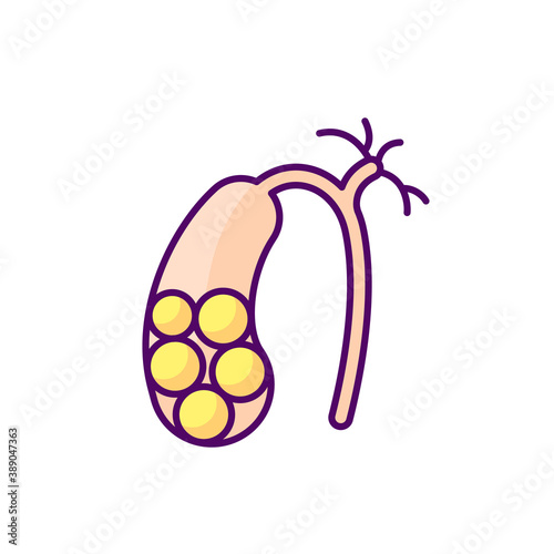 Gallstones RGB color icon. Cholelithiasis. Hardened bile deposits. Solid material in gallbladder. Gall stones. Digestive discomfort. Abdominal pain. Bile ducts. Isolated vector illustration