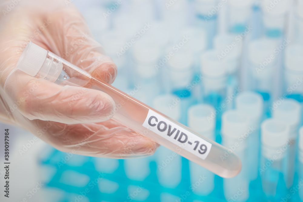 Hand in protective gloves holds biological tube with covid-19 sample. Study of coronavirus in laboratory. Healthcare and medical concept.