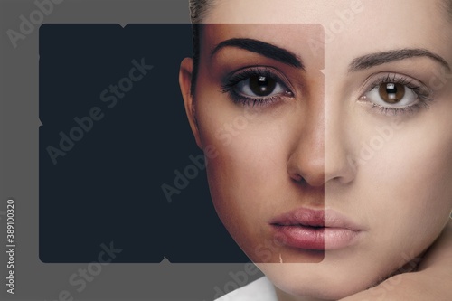 Hyperpigmentation. photo