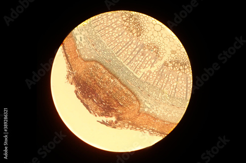 Real photo of plant cells lentil under the microscope photo