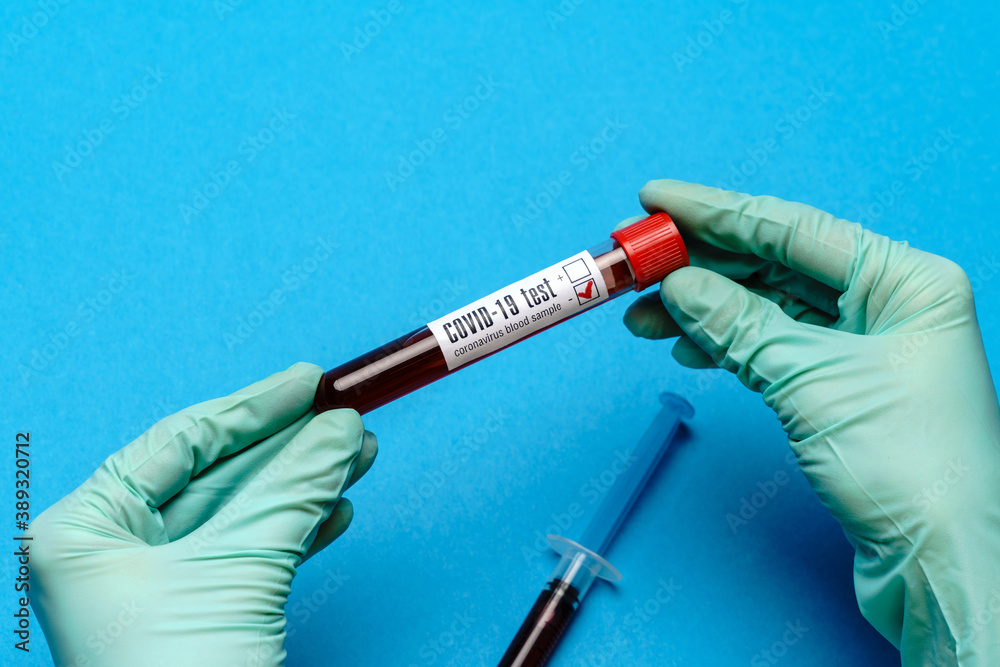 lab technician assistant or doctor holding a blood sample in test tube lab technician assistant or doctor holding a blood sample in test tube