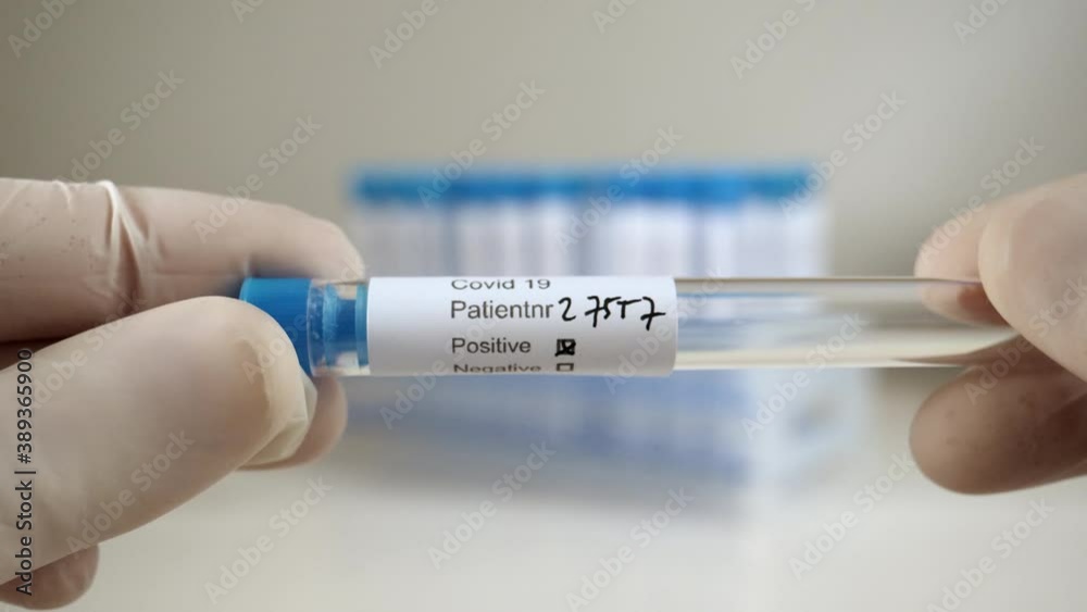 Inspecting a label on a Covid19 test tube. Close up. Inspecting a label on a Covid19 test tube. Close up.