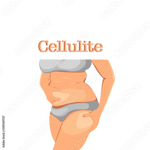 Vector isolate flat design of woman body with cellulite on belly and thigh. Cartoon of fat woman wearing sportswear and standing,right hand on the abdomen The left hand holds the thigh.