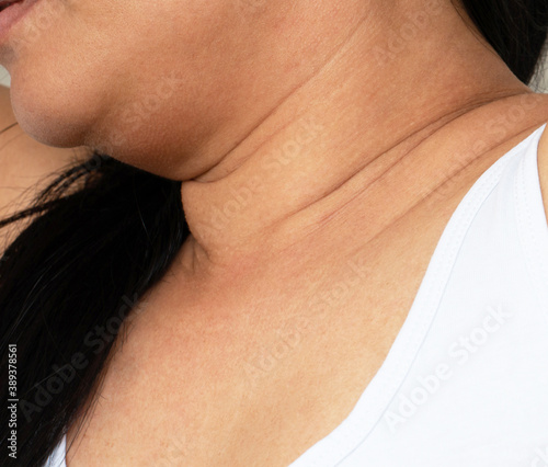 Asian woman double chin