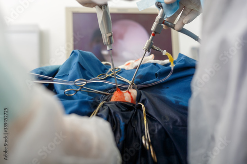 Surgery with multiple punctures and the use of an endoscope