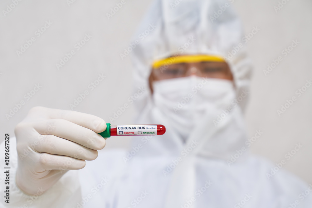 Blood tube test for covid19 pandemic situation show by scientist for healthcare Blood tube test for covid19 pandemic situation show by scientist for healthcare