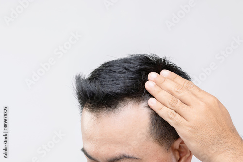 Portrait Asian man with worry feeling and touching on his head to show bald head or Glabrous problem. Studio shoot with copy space with grey