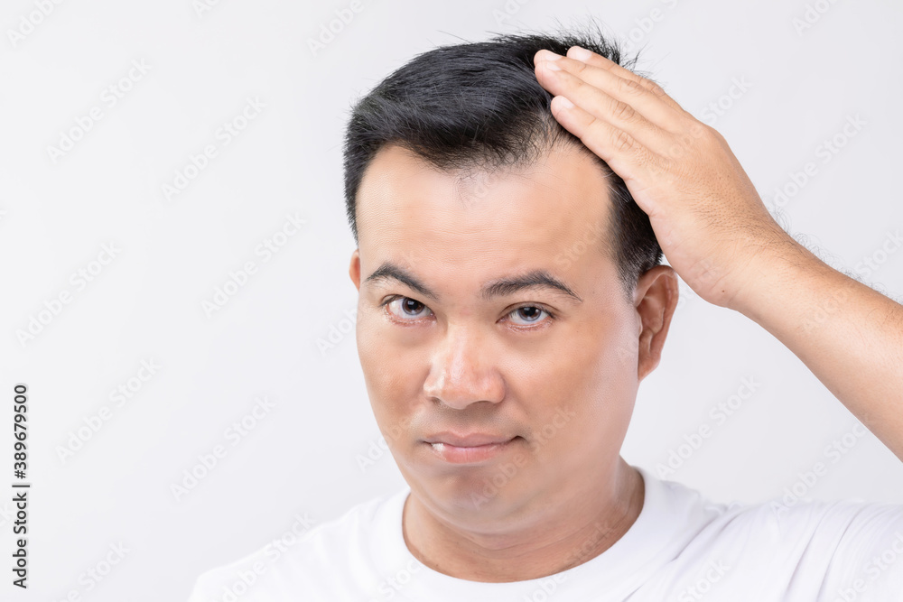 Portrait Asian man with worry feeling and touching on his head to show bald head or Glabrous problem. Studio shoot with copy space with grey Portrait Asian man with worry feeling and touching on his head to show bald head or Glabrous problem. Studio shoot with copy space with grey