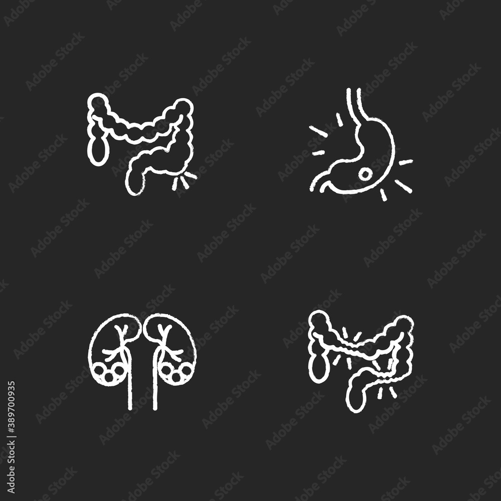 Obraz premium Abdominal pain chalk white icons set on black background. Constipation. Gastritis. Kidney stones. Irritable bowel syndrome. Urolithiasis. Stomach ulcer. Isolated vector chalkboard illustrations