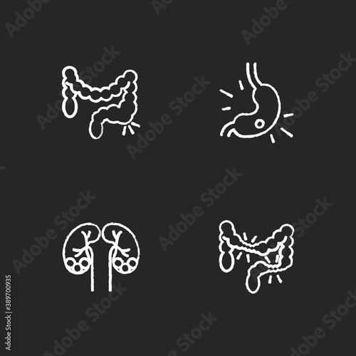 Abdominal pain chalk white icons set on black background. Constipation. Gastritis. Kidney stones. Irritable bowel syndrome. Urolithiasis. Stomach ulcer. Isolated vector chalkboard illustrations