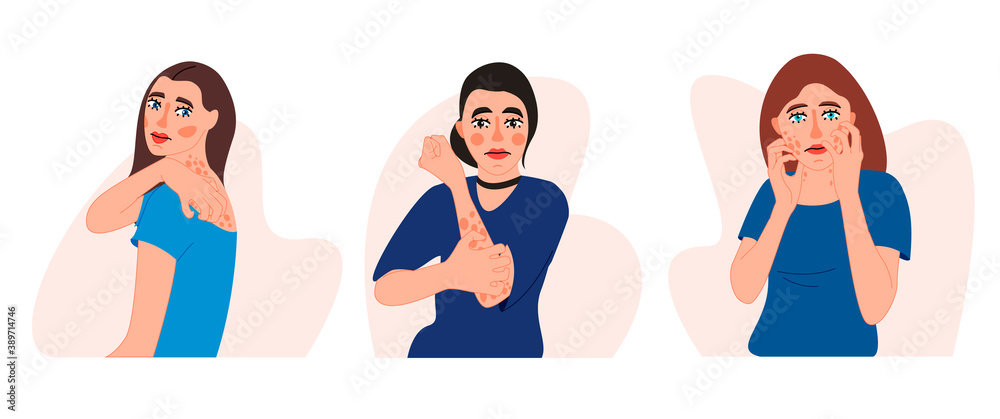 Allergic rash reaction isolated on white vector illustration. Female character suffers from eczema design element. Dermatology symptom in cartoon style. Allergic rash reaction isolated on white vector illustration. Female character suffers from eczema design element. Dermatology symptom in cartoon style.