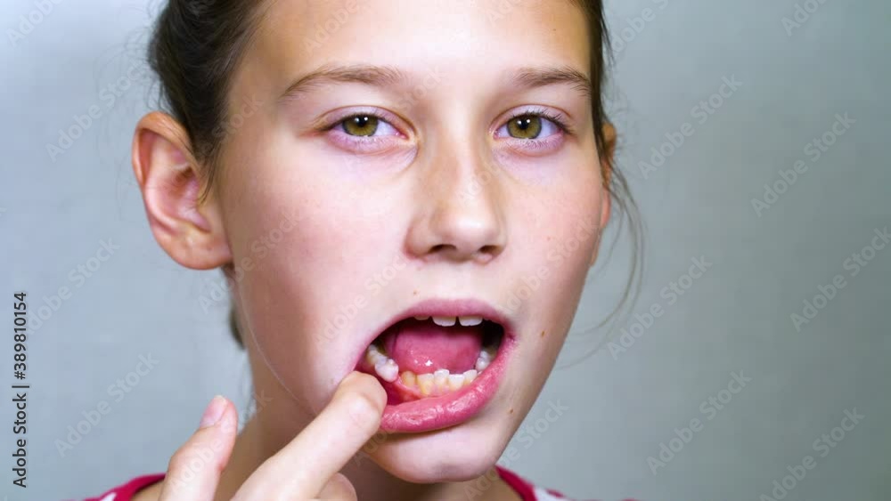 Vidéo Stock Girl keeping mouth open with fingers and shaking wobbly