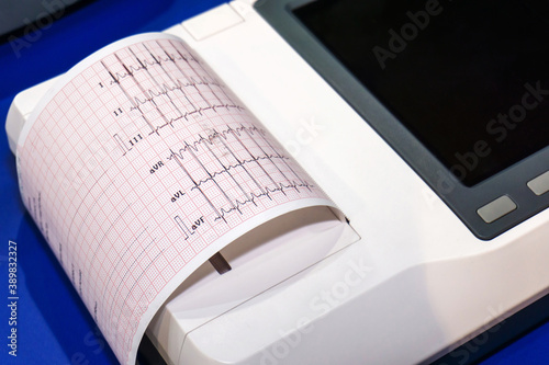 ECG device with printout on paper. Mobile equipment for the rapid diagnosis of heart disease.