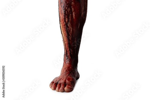 Bleeding human leg isolated on white background. photo