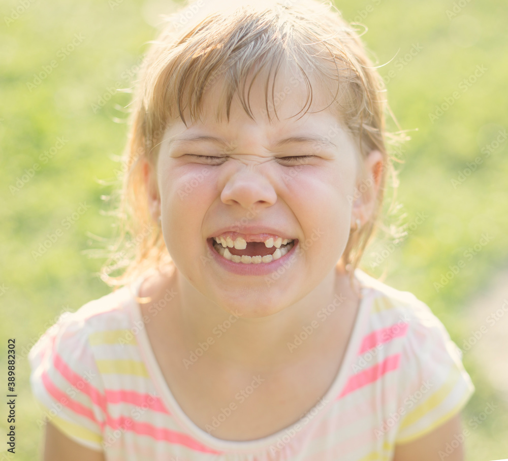 Cute young child make grimace with missing teeth Cute young child make grimace with missing teeth