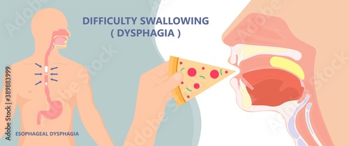 Dysphagia infection trachea examine Surgery choking gastric diagnose windpipe disorder bleeding surgical GERD treat tumor throat biopsy system ulcers stomach block eat food stuck test tract stent pain