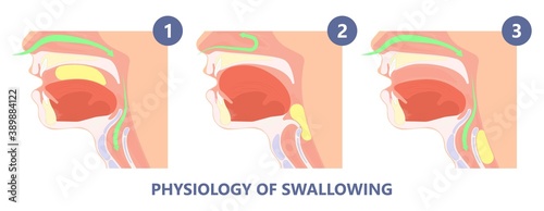 Dysphagia infection trachea examine Surgery choking gastric diagnose windpipe disorder bleeding surgical GERD treat tumor throat biopsy system ulcers stomach block eat food stuck test tract stent pain